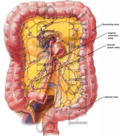 Mesenteric Lymphadenitis Symptoms Causes Risk Factors And